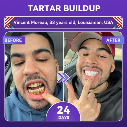 𝑶𝒇𝒇𝒊𝒄𝒊𝒂𝒍 𝑺𝒕𝒐𝒓𝒆  | 𝐺𝑙𝑖𝑚𝑚𝑒𝑟𝑙𝑦® 𝐴𝑑𝑣𝑎𝑛𝑐𝑒𝑑 𝑊ℎ𝑖𝑡𝑒𝑛𝑖𝑛𝑔 𝑆𝑡𝑟𝑖𝑝𝑠 🌿