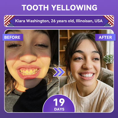 𝑶𝒇𝒇𝒊𝒄𝒊𝒂𝒍 𝑺𝒕𝒐𝒓𝒆  | 𝐺𝑙𝑖𝑚𝑚𝑒𝑟𝑙𝑦® 𝐴𝑑𝑣𝑎𝑛𝑐𝑒𝑑 𝑊ℎ𝑖𝑡𝑒𝑛𝑖𝑛𝑔 𝑆𝑡𝑟𝑖𝑝𝑠 🌿