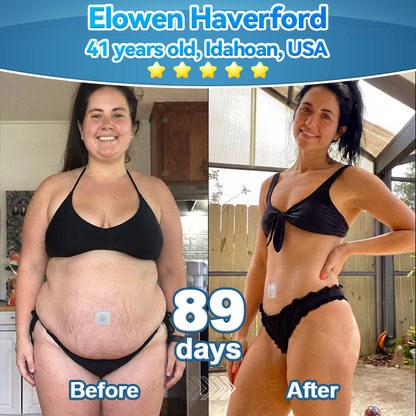 𝑶𝒇𝒇𝒊𝒄𝒊𝒂𝒍 𝑺𝒕𝒐𝒓𝒆  | 𝑭𝒍𝒐𝒓𝒊𝒔𝒎𝒂® 𝑷𝒍𝒂𝒏𝒕-𝑫𝒆𝒓𝒊𝒗𝒆𝒅 𝑪𝒆𝒍𝒍𝒖𝒍𝒂𝒓 𝑺𝒖𝒑𝒑𝒐𝒓𝒕 𝑪𝒐𝒎𝒑𝒍𝒆𝒙 𝑷𝒂𝒕𝒄𝒉（Improve lymphatic drainage and reduce body weight）