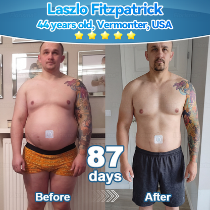 𝑶𝒇𝒇𝒊𝒄𝒊𝒂𝒍 𝑺𝒕𝒐𝒓𝒆  | 𝑭𝒍𝒐𝒓𝒊𝒔𝒎𝒂® 𝑷𝒍𝒂𝒏𝒕-𝑫𝒆𝒓𝒊𝒗𝒆𝒅 𝑪𝒆𝒍𝒍𝒖𝒍𝒂𝒓 𝑺𝒖𝒑𝒑𝒐𝒓𝒕 𝑪𝒐𝒎𝒑𝒍𝒆𝒙 𝑷𝒂𝒕𝒄𝒉（Improve lymphatic drainage and reduce body weight）
