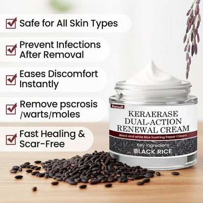 𝐎𝐟𝐟𝐢𝐜𝐢𝐚𝐥 𝐒𝐭𝐨𝐫𝐞 |Bostore® KeraErase Dual-Action Renewal Cream (Quick and painless removal of warts, moles, age spots, and skin tags with no side effects) 🎉