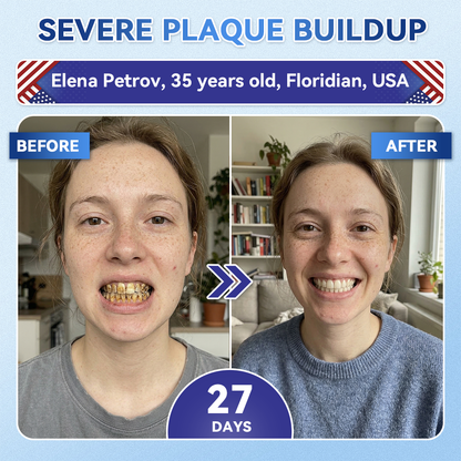 🦷𝐆𝐥𝐢𝐦𝐦𝐞𝐫𝐥𝐲® 𝐓𝐢𝐝𝐞𝐠𝐥𝐮𝐬𝐢𝐛 𝐓𝐨𝐨𝐭𝐡 & 𝐆𝐮𝐦 𝐑𝐞𝐩𝐚𝐢𝐫 𝐌𝐢𝐜𝐫𝐨𝐧𝐞𝐞𝐝𝐥𝐞 𝐏𝐚𝐭𝐜𝐡  | 𝐀𝐝𝐯𝐚𝐧𝐜𝐞𝐝 𝐒𝐭𝐞𝐦-𝐂𝐞𝐥𝐥 𝐀𝐜𝐭𝐢𝐯𝐚𝐭𝐢𝐨𝐧 𝐓𝐞𝐞𝐭𝐡 𝐒𝐭𝐫𝐢𝐩𝐬(🦷𝐑𝐞𝐛𝐮𝐢𝐥𝐝 𝐄𝐧𝐚𝐦𝐞𝐥 & 𝐃𝐞𝐧𝐭𝐢𝐧 • 𝐒𝐭𝐫𝐞𝐧𝐠𝐭𝐡𝐞𝐧 𝐆𝐮𝐦𝐬 • 𝐄𝐫𝐚𝐝𝐢𝐜𝐚𝐭𝐞 𝐓𝐚𝐫𝐭𝐚𝐫 & 𝐎𝐝𝐨𝐫 • 𝐒𝐭𝐨𝐩 𝐓𝐨𝐨𝐭𝐡 𝐒𝐞𝐧𝐬𝐢𝐭𝐢𝐯𝐢𝐭𝐲)