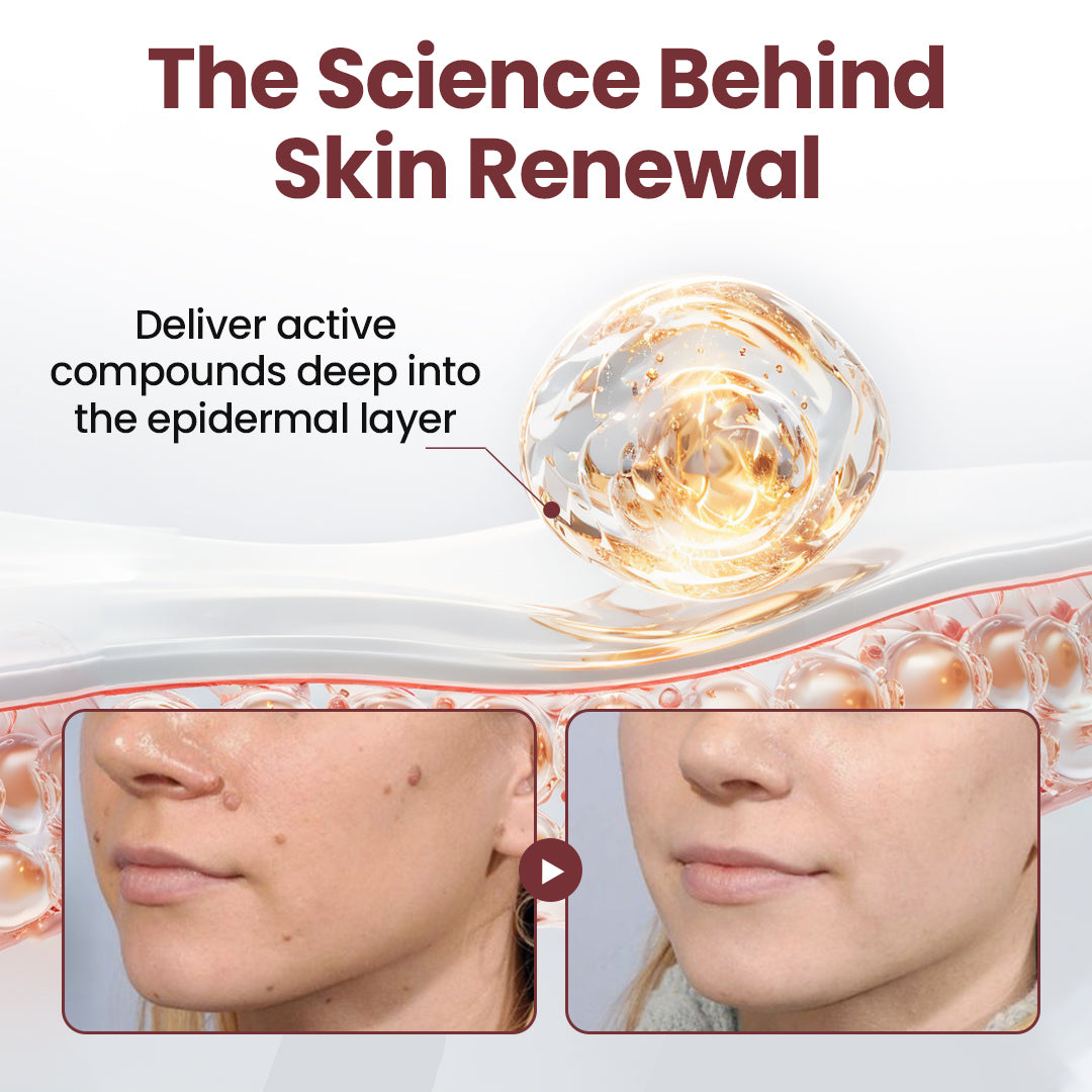 𝐎𝐟𝐟𝐢𝐜𝐢𝐚𝐥 𝐒𝐭𝐨𝐫𝐞 |Bostore® KeraErase Dual-Action Renewal Cream (Quick and painless removal of warts, moles, age spots, and skin tags with no side effects) 🎉