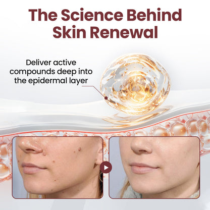 𝐎𝐟𝐟𝐢𝐜𝐢𝐚𝐥 𝐒𝐭𝐨𝐫𝐞 |Bostore® KeraErase Dual-Action Renewal Cream (Quick and painless removal of warts, moles, age spots, and skin tags with no side effects) 🎉