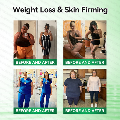 𝑶𝒇𝒇𝒊𝒄𝒊𝒂𝒍 𝑺𝒕𝒐𝒓𝒆  | 👩‍⚕️ 𝑳𝒖𝒙𝒂𝒓𝒊𝒔𝒆® 𝑴𝒐𝒓𝒊𝒏𝒈𝒂 & 𝑩𝒆𝒓𝒃𝒆𝒓𝒊𝒏𝒆 10-𝑰𝑵-1 𝑨𝒅𝒗𝒂𝒏𝒄𝒆𝒅 𝑵𝒂𝒏𝒐 𝑴𝒊𝒄𝒓𝒐𝒏𝒆𝒆𝒅𝒍𝒆 𝑷𝒂𝒕𝒄𝒉 (𝐎𝐧𝐜𝐞 𝐃𝐚𝐢𝐥𝐲, 𝐯𝐢𝐬𝐢𝐛𝐥𝐞 𝐜𝐡𝐚𝐧𝐠𝐞𝐬 𝐢𝐧 𝟕 𝐝𝐚𝐲𝐬）✅ 𝐎𝐛𝐞𝐬𝐢𝐭𝐲, 𝐃𝐢𝐚𝐛𝐞𝐭𝐞𝐬, 𝐒𝐥𝐞𝐞𝐩 𝐀𝐩𝐧𝐞𝐚, 𝐀𝐧𝐝 𝐉𝐨𝐢𝐧𝐭 𝐈𝐬𝐬𝐮𝐞𝐬 🔥