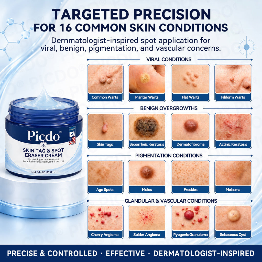 𝐏𝐢𝐜𝐝𝐨® 7-𝐃𝐚𝐲 𝐒𝐤𝐢𝐧 𝐓𝐚𝐠 & 𝐒𝐩𝐨𝐭 𝐄𝐫𝐚𝐬𝐞𝐫 𝐂𝐫𝐞𝐚𝐦 (Zero Pain, Zero 𝐒𝐜𝐚𝐫𝐬 Formula) 🌹