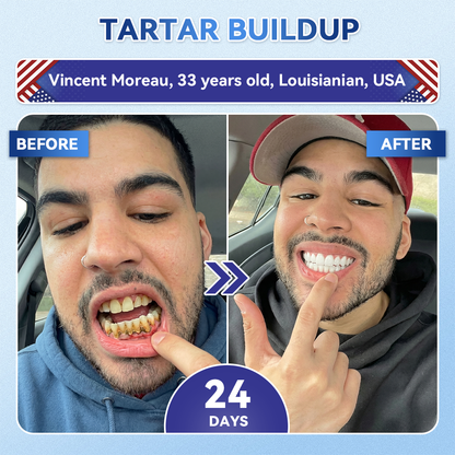 🦷𝐆𝐥𝐢𝐦𝐦𝐞𝐫𝐥𝐲® 𝐓𝐢𝐝𝐞𝐠𝐥𝐮𝐬𝐢𝐛 𝐓𝐨𝐨𝐭𝐡 & 𝐆𝐮𝐦 𝐑𝐞𝐩𝐚𝐢𝐫 𝐌𝐢𝐜𝐫𝐨𝐧𝐞𝐞𝐝𝐥𝐞 𝐏𝐚𝐭𝐜𝐡  | 𝐀𝐝𝐯𝐚𝐧𝐜𝐞𝐝 𝐒𝐭𝐞𝐦-𝐂𝐞𝐥𝐥 𝐀𝐜𝐭𝐢𝐯𝐚𝐭𝐢𝐨𝐧 𝐓𝐞𝐞𝐭𝐡 𝐒𝐭𝐫𝐢𝐩𝐬(🦷𝐑𝐞𝐛𝐮𝐢𝐥𝐝 𝐄𝐧𝐚𝐦𝐞𝐥 & 𝐃𝐞𝐧𝐭𝐢𝐧 • 𝐒𝐭𝐫𝐞𝐧𝐠𝐭𝐡𝐞𝐧 𝐆𝐮𝐦𝐬 • 𝐄𝐫𝐚𝐝𝐢𝐜𝐚𝐭𝐞 𝐓𝐚𝐫𝐭𝐚𝐫 & 𝐎𝐝𝐨𝐫 • 𝐒𝐭𝐨𝐩 𝐓𝐨𝐨𝐭𝐡 𝐒𝐞𝐧𝐬𝐢𝐭𝐢𝐯𝐢𝐭𝐲)