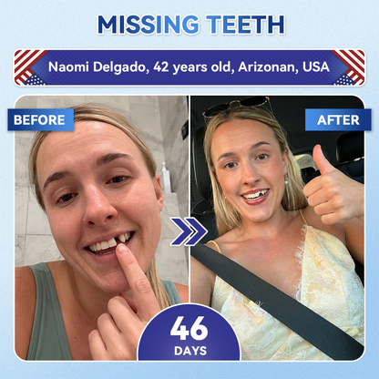 𝐺𝑙𝑖𝑚𝑚𝑒𝑟𝑙𝑦® 𝑇𝑖𝑑𝑒𝑔𝑙𝑢𝑠𝑖𝑏 𝑇𝑜𝑜𝑡ℎ & 𝐺𝑢𝑚 𝑅𝑒𝑝𝑎𝑖𝑟 𝐹𝑎𝑠𝑡-𝐷𝑖𝑠𝑠𝑜𝑙𝑣𝑖𝑛𝑔 𝑂𝑟𝑎𝑙 𝑆𝑡𝑟𝑖𝑝𝑠🦷
