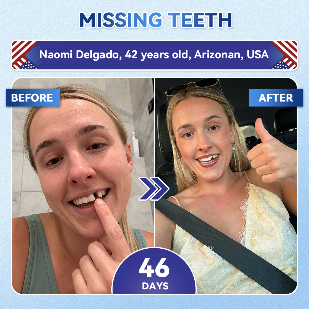 🦷𝐆𝐥𝐢𝐦𝐦𝐞𝐫𝐥𝐲® 𝐓𝐢𝐝𝐞𝐠𝐥𝐮𝐬𝐢𝐛 𝐓𝐨𝐨𝐭𝐡 & 𝐆𝐮𝐦 𝐑𝐞𝐩𝐚𝐢𝐫 𝐌𝐢𝐜𝐫𝐨𝐧𝐞𝐞𝐝𝐥𝐞 𝐏𝐚𝐭𝐜𝐡  | 𝐀𝐝𝐯𝐚𝐧𝐜𝐞𝐝 𝐒𝐭𝐞𝐦-𝐂𝐞𝐥𝐥 𝐀𝐜𝐭𝐢𝐯𝐚𝐭𝐢𝐨𝐧 𝐓𝐞𝐞𝐭𝐡 𝐒𝐭𝐫𝐢𝐩𝐬(🦷𝐑𝐞𝐛𝐮𝐢𝐥𝐝 𝐄𝐧𝐚𝐦𝐞𝐥 & 𝐃𝐞𝐧𝐭𝐢𝐧 • 𝐒𝐭𝐫𝐞𝐧𝐠𝐭𝐡𝐞𝐧 𝐆𝐮𝐦𝐬 • 𝐄𝐫𝐚𝐝𝐢𝐜𝐚𝐭𝐞 𝐓𝐚𝐫𝐭𝐚𝐫 & 𝐎𝐝𝐨𝐫 • 𝐒𝐭𝐨𝐩 𝐓𝐨𝐨𝐭𝐡 𝐒𝐞𝐧𝐬𝐢𝐭𝐢𝐯𝐢𝐭𝐲)