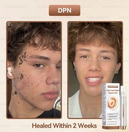 𝐎𝐟𝐟𝐢𝐜𝐢𝐚𝐥 𝐒𝐭𝐨𝐫𝐞| 𝐷𝑂𝑅𝑀𝑂𝑅𝑁𝐴® 𝑆𝑡𝑒𝑚 𝐶𝑒𝑙𝑙 𝑃𝐷𝑅𝑁 𝑅𝑒𝑝𝑎𝑖𝑟 𝑀𝑖𝑙𝑘 | 𝑊𝑖𝑡ℎ 2000𝑃𝑃𝑀 𝐸𝑥𝑜𝑠𝑜𝑚𝑒-𝑐𝑜𝑎𝑡𝑒𝑑 𝑆𝑝𝑖𝑐𝑢𝑙𝑒𝑠 🔥🔥🔥