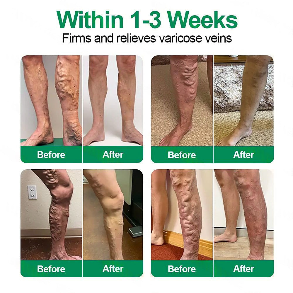 [FDA-Registered & GMP Certified]| 𝐅𝗹𝒐𝐫𝐢𝒔𝗺𝙖® 🇺🇸𝐕𝗲𝐢𝐧𝐓𝙖𝐫𝐠𝗲𝐭 𝐌𝐢𝐜𝐫𝐨𝐧𝗲𝗲𝐝𝗹𝐞 𝐏𝙖𝐭𝐜𝐡🌿Instant Relief, Long-Term Results