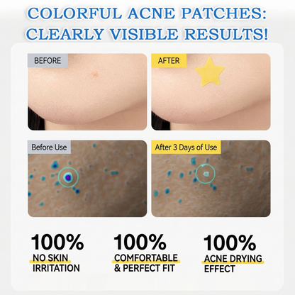 🌟Bostore® Star Pimple Patches: 2-in-1 Microneedle & Hydrocolloid Zit Stickers (6 Colors)
