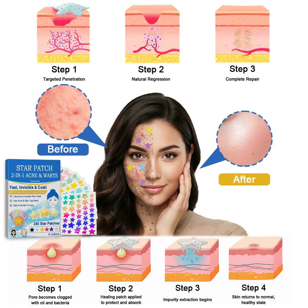 🌟Bostore® Star Pimple Patches: 2-in-1 Microneedle & Hydrocolloid Zit Stickers (6 Colors)