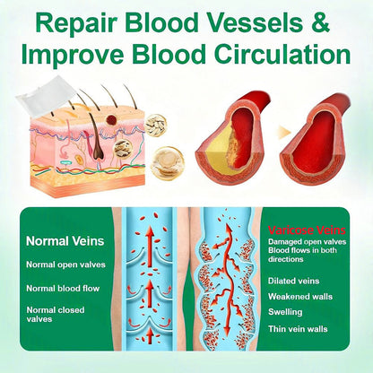 [FDA-Registered & GMP Certified]| 𝐅𝗹𝒐𝐫𝐢𝒔𝗺𝙖® 🇺🇸𝐕𝗲𝐢𝐧𝐓𝙖𝐫𝐠𝗲𝐭 𝐌𝐢𝐜𝐫𝐨𝐧𝗲𝗲𝐝𝗹𝐞 𝐏𝙖𝐭𝐜𝐡🌿Instant Relief, Long-Term Results