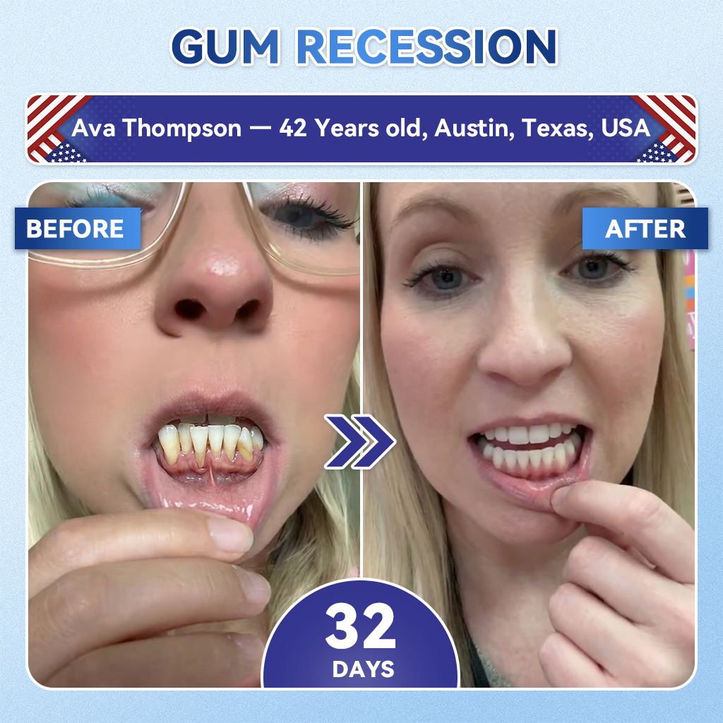𝐆𝐥𝐢𝐦𝐦𝐞𝐫𝐥𝐲® 🦷𝐓𝐢𝐝𝐞𝐠𝐥𝐮𝐬𝐢𝐛 𝐓𝐨𝐨𝐭𝐡 & 𝐆𝐮𝐦 𝐑𝐞𝐩𝐚𝐢𝐫 𝐌𝐢𝐜𝐫𝐨𝐧𝐞𝐞𝐝𝐥𝐞 𝐏𝐚𝐭𝐜𝐡  | 𝐀𝐝𝐯𝐚𝐧𝐜𝐞𝐝 𝐒𝐭𝐞𝐦-𝐂𝐞𝐥𝐥 𝐀𝐜𝐭𝐢𝐯𝐚𝐭𝐢𝐨𝐧 𝐓𝐞𝐞𝐭𝐡 𝐒𝐭𝐫𝐢𝐩𝐬(𝐑𝐞𝐛𝐮𝐢𝐥𝐝 𝐄𝐧𝐚𝐦𝐞𝐥 & 𝐃𝐞𝐧𝐭𝐢𝐧 • 𝐒𝐭𝐫𝐞𝐧𝐠𝐭𝐡𝐞𝐧 𝐆𝐮𝐦𝐬 • 𝐄𝐫𝐚𝐝𝐢𝐜𝐚𝐭𝐞 𝐓𝐚𝐫𝐭𝐚𝐫 & 𝐎𝐝𝐨𝐫 • 𝐒𝐭𝐨𝐩 𝐓𝐨𝐨𝐭𝐡 𝐒𝐞𝐧𝐬𝐢𝐭𝐢𝐯𝐢𝐭𝐲)🌺